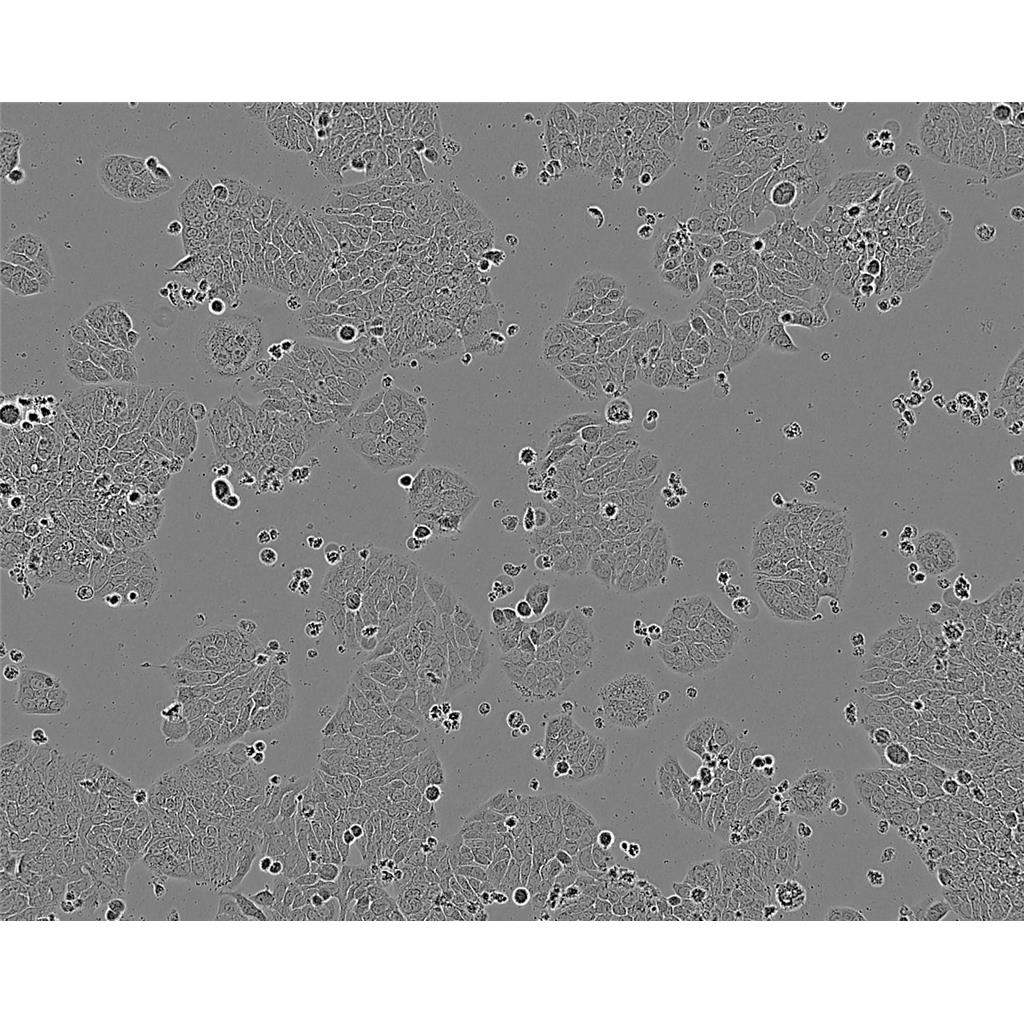 MFE-280 Cells人子宫内膜腺癌贴壁细胞系(赠送STR基因图谱)