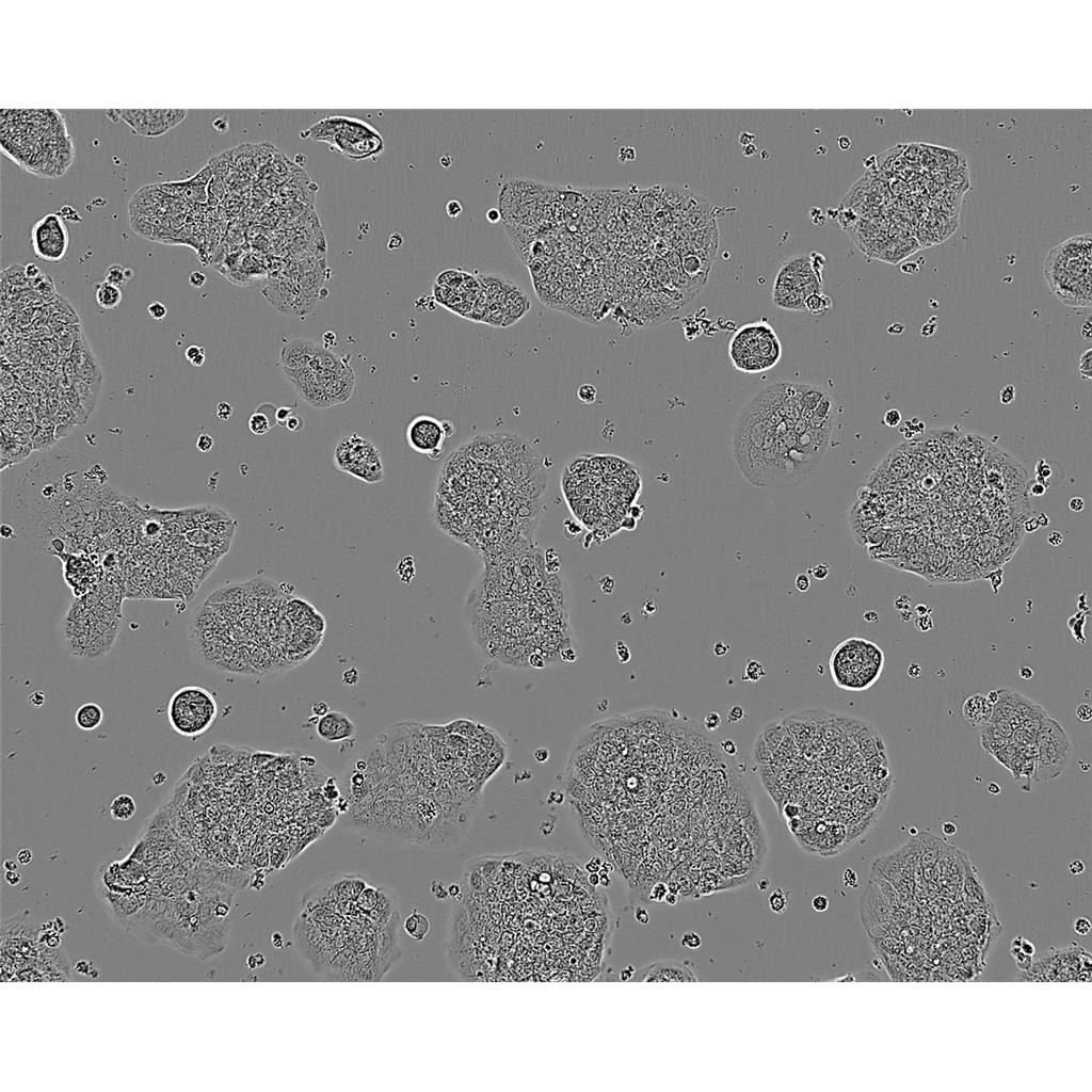 KMS-11 Cells人多发性骨髓瘤克隆贴壁细胞系(赠送STR基因图谱)