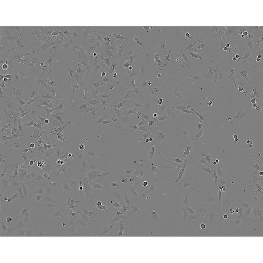 TE-12 Cells人食管癌贴壁细胞系(赠送STR基因图谱)