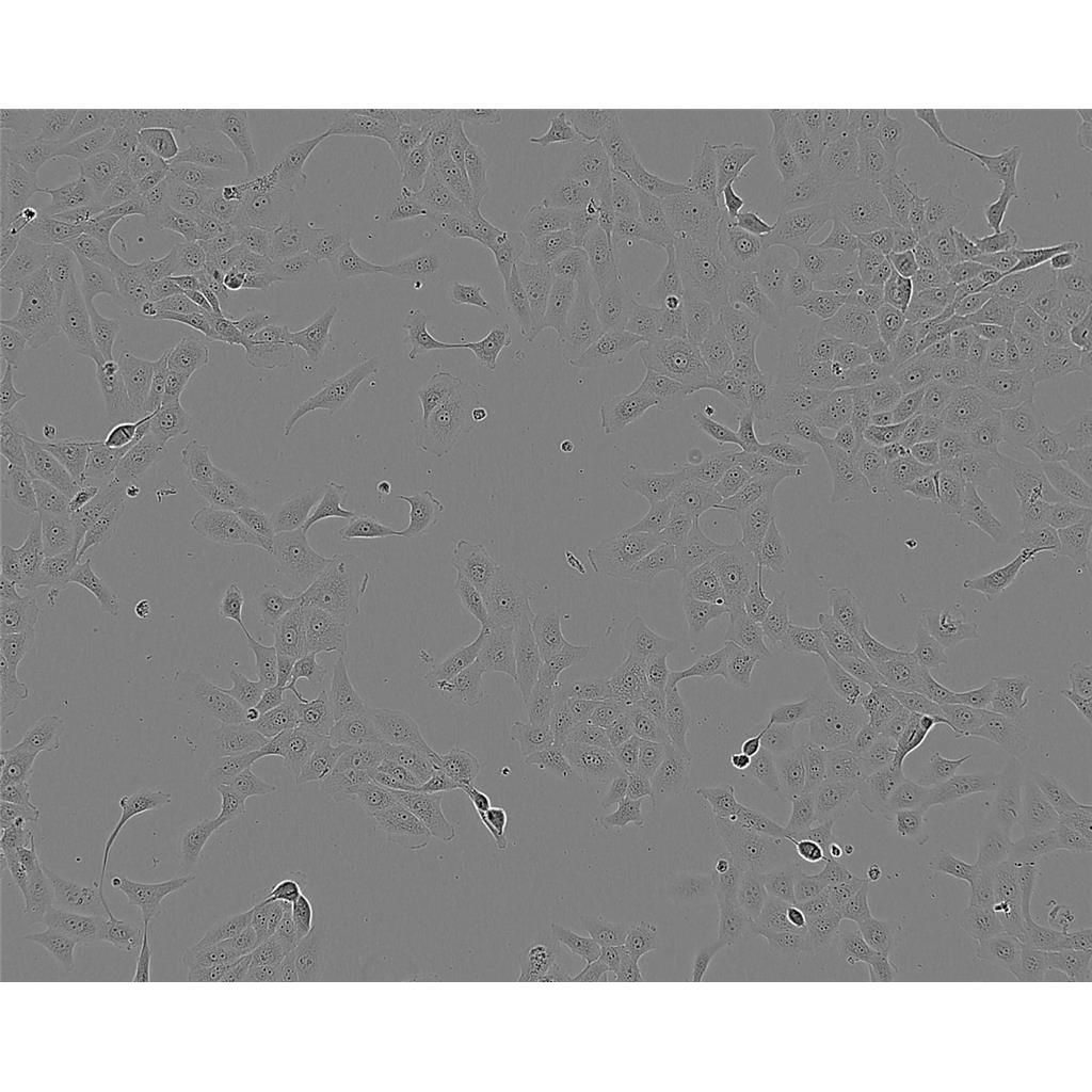 HKb20 Cells人肾上皮贴壁细胞系(赠送STR基因图谱)