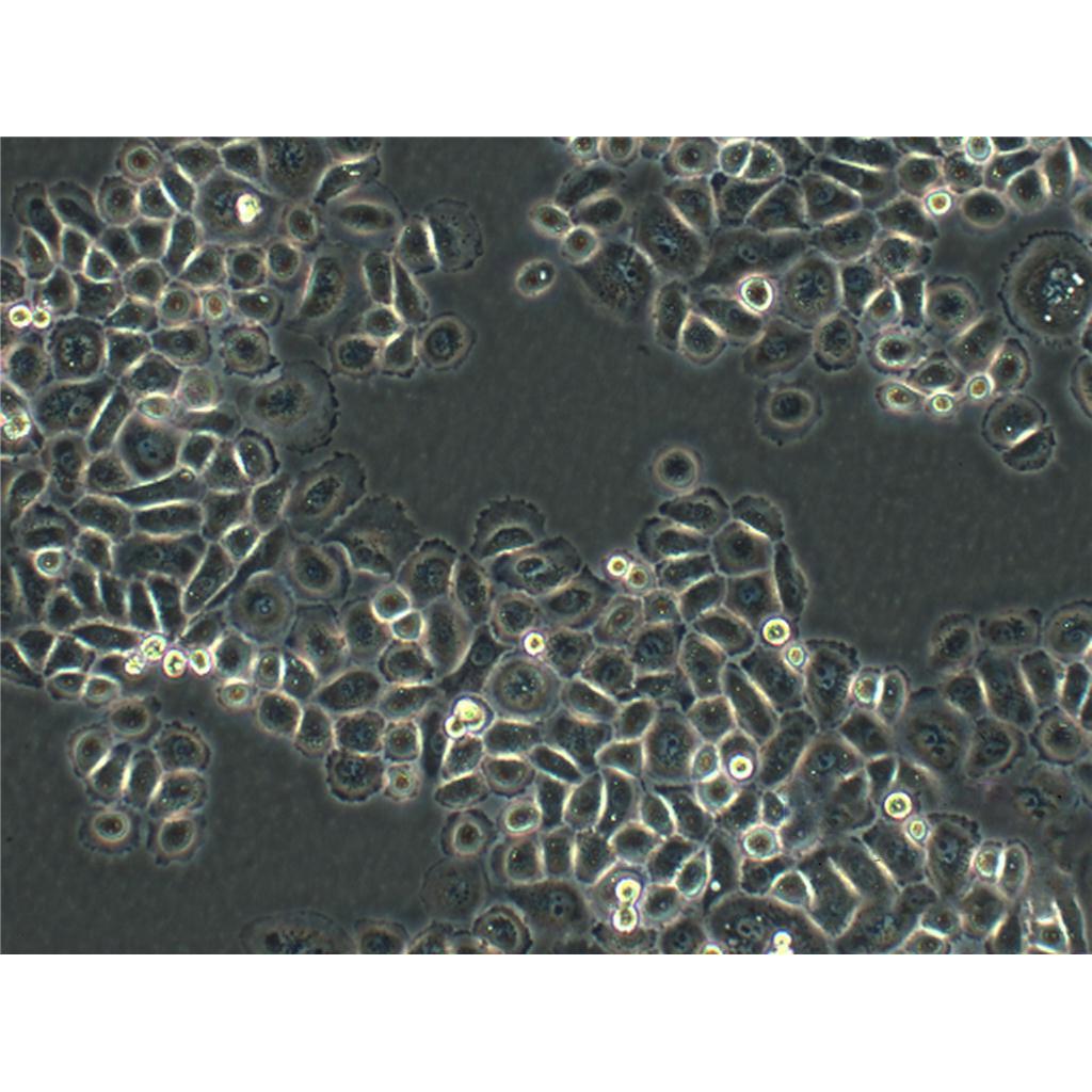 Mahlavu Cells人肝癌贴壁细胞系(赠送STR基因图谱)