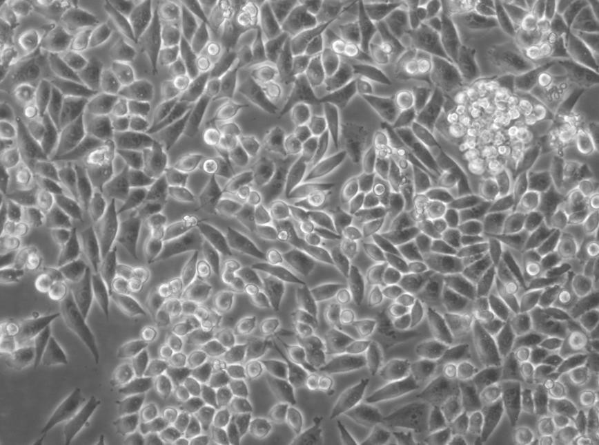 BC-3 Cells人淋巴瘤贴壁细胞系(赠送STR基因图谱)