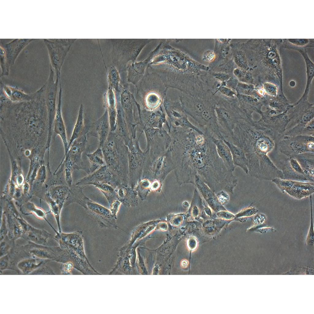 HMY-1 Cells人黑色素瘤贴壁细胞系(赠送STR基因图谱)