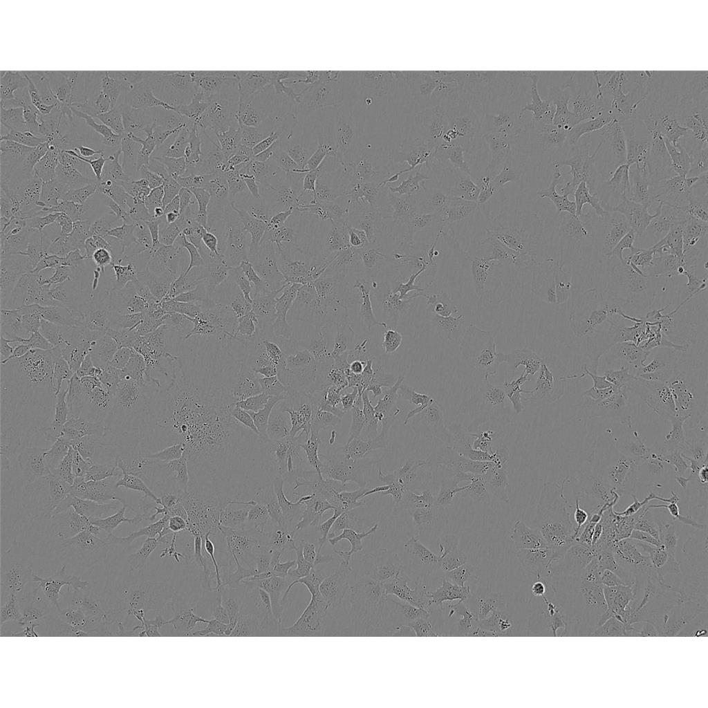 Hela 229 Cells人宫颈癌贴壁细胞系(赠送STR基因图谱)