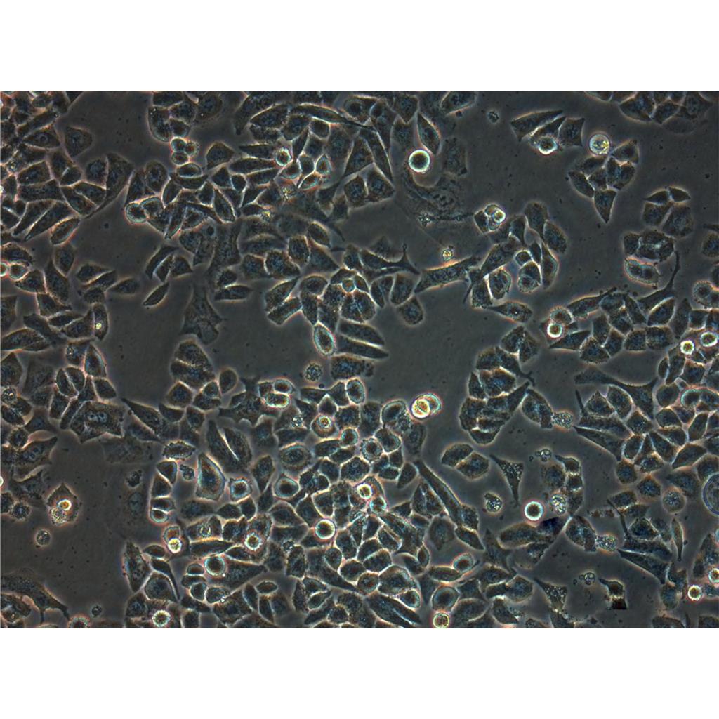 SK-N-AS Cells人神经母细胞瘤贴壁细胞系(赠送STR基因图谱)