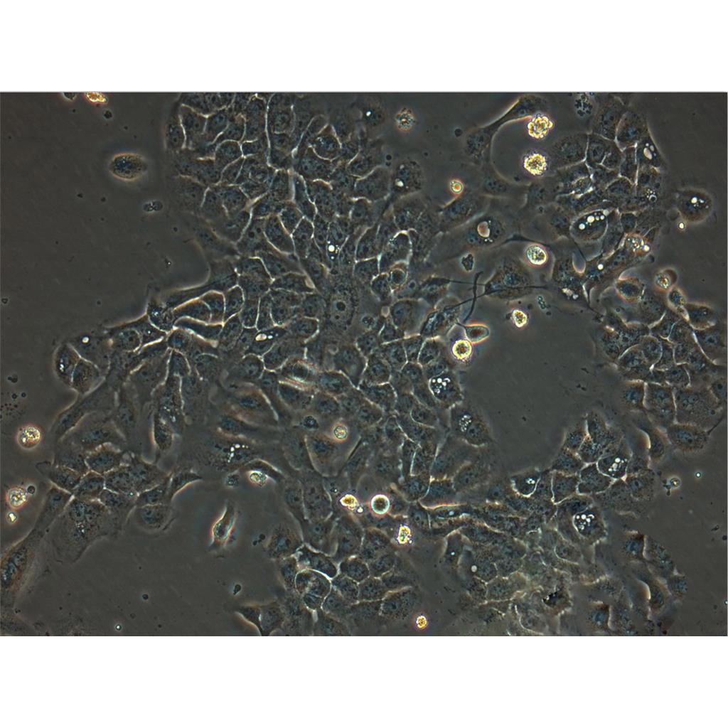 NCI-H3122 Cells#人非小细胞肺癌细胞系保种中心(通过STR鉴定)