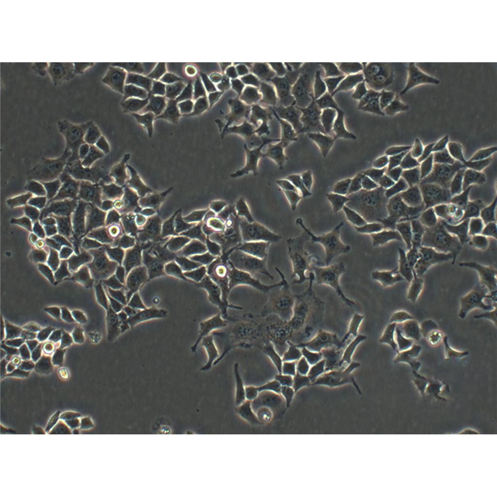 SK-LU-1 Cells#人低分化肺腺癌细胞系保种中心(通过STR鉴定)