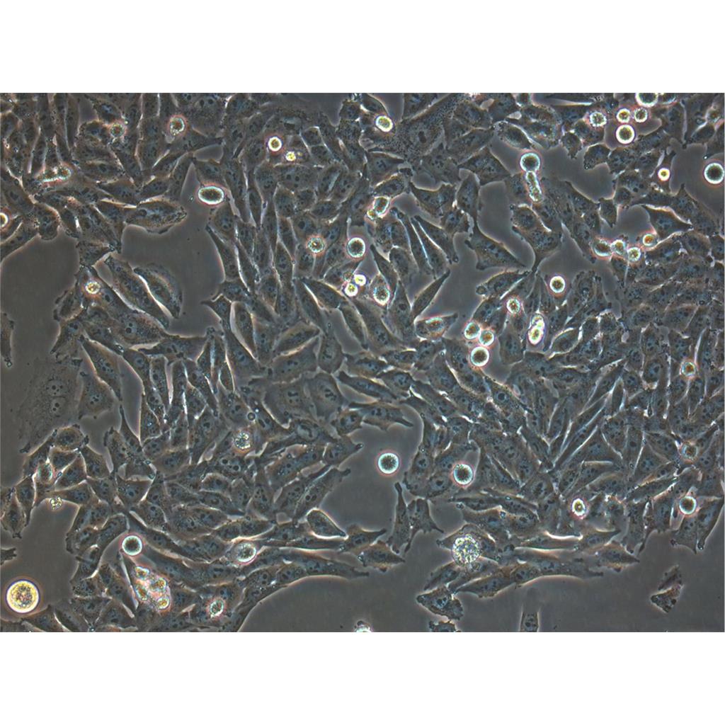 SJSA-1 Cells#人骨肉瘤细胞系保种中心(通过STR鉴定)