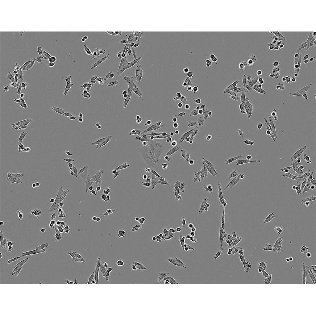 FTC-133 Cells#人滤泡状甲状腺癌细胞系保种中心(通过STR鉴定)