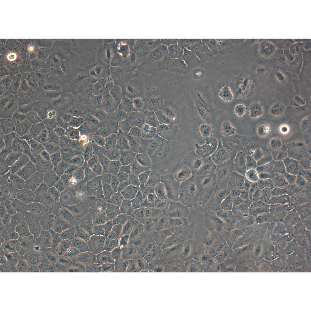 6-T CEM Cells人T细胞白血病可传代细胞系(送STR鉴定图谱)