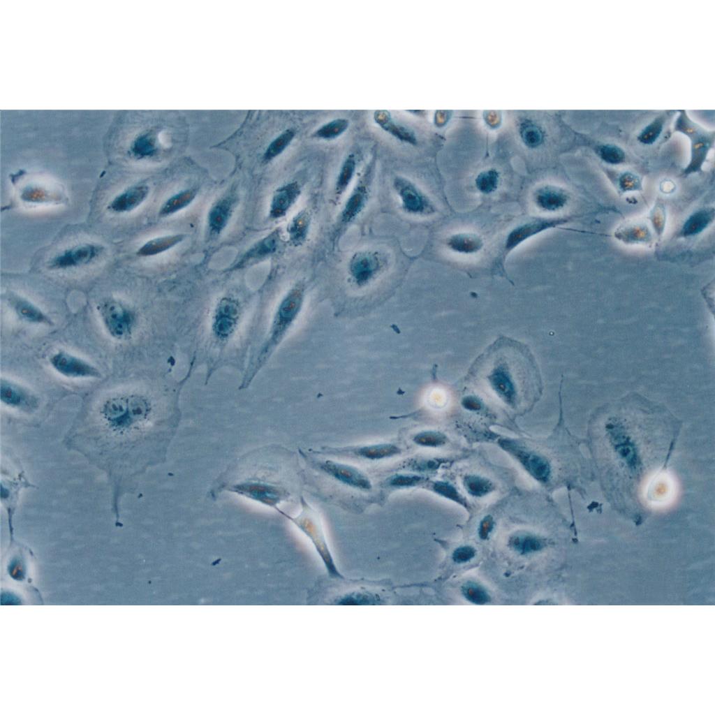 IHH-4 Cells#人甲状腺乳头状癌细胞系保种中心(通过STR鉴定)