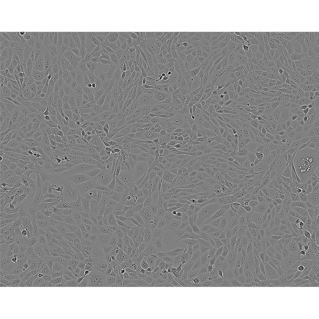 SW48 Cells#人结肠腺癌细胞系来源可靠|培养基|带STR基因图谱