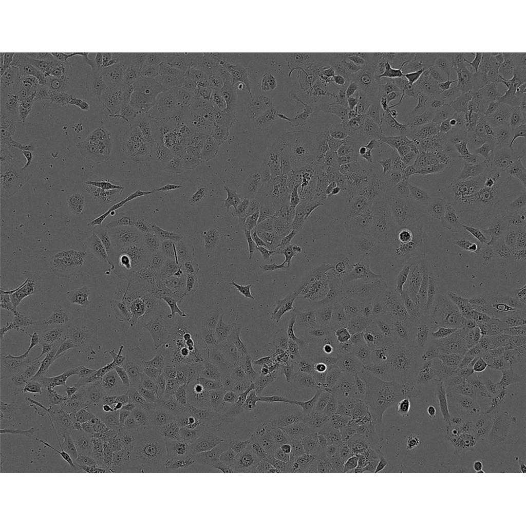 NCI-H929 Cells#人骨髓瘤细胞系来源可靠|培养基|带STR基因图谱