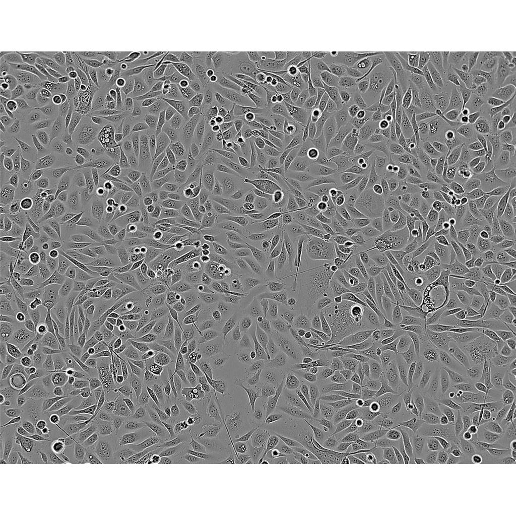 AN3 CA Cells#人子宫内膜腺癌细胞系来源可靠|培养基|带STR基因图谱