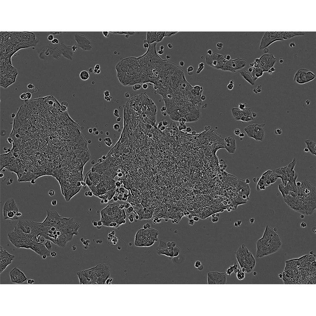 TE-10 Cells#人食管癌细胞系来源可靠|培养基|带STR基因图谱