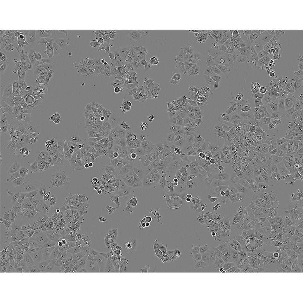 SK-CO-1 Cells#人结直肠腺癌细胞系来源可靠|培养基|带STR基因图谱