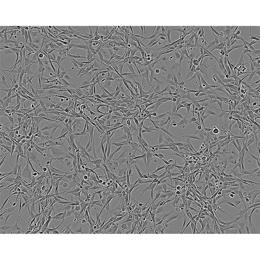 Hs 578T Cells#人乳腺癌细胞系来源可靠|培养基|带STR基因图谱