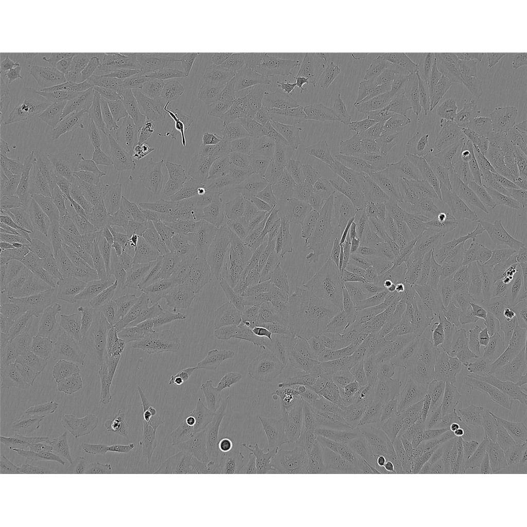 CFPAC Cells#人胰腺导管癌细胞系种子库|完全培养基|STR图谱