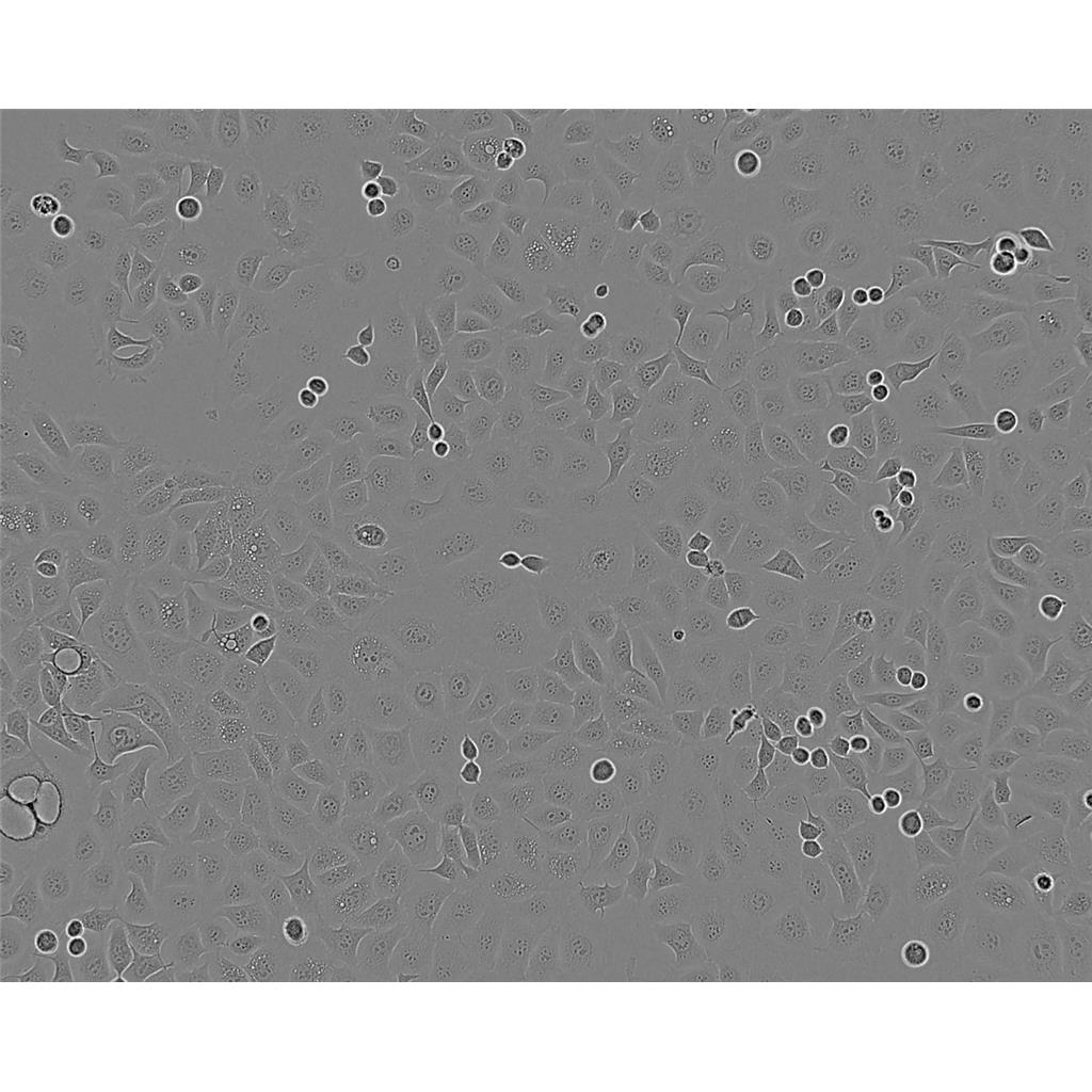 CFPAC1 Cells#人胰腺导管癌细胞系种子库|完全培养基|STR图谱