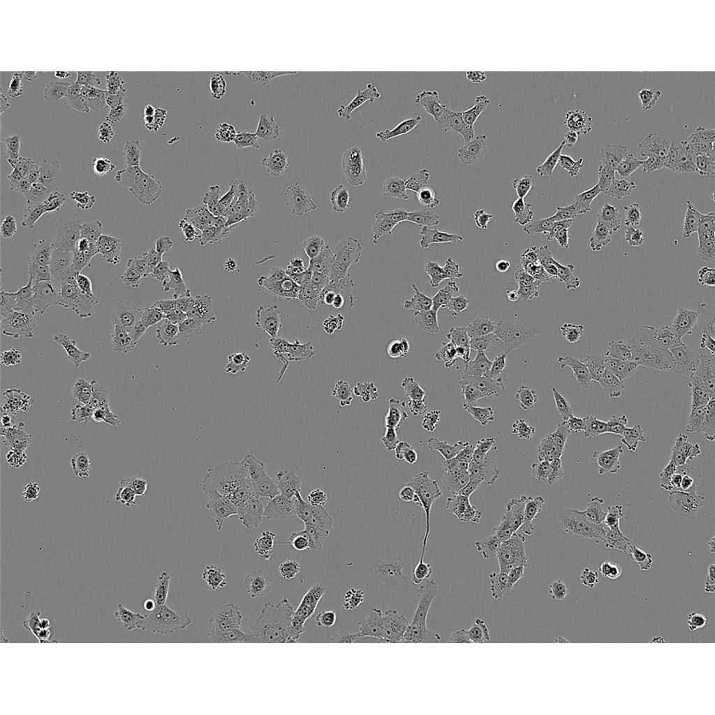 HUCCT1 Cells#人胆管癌细胞系种子库|完全培养基|STR图谱