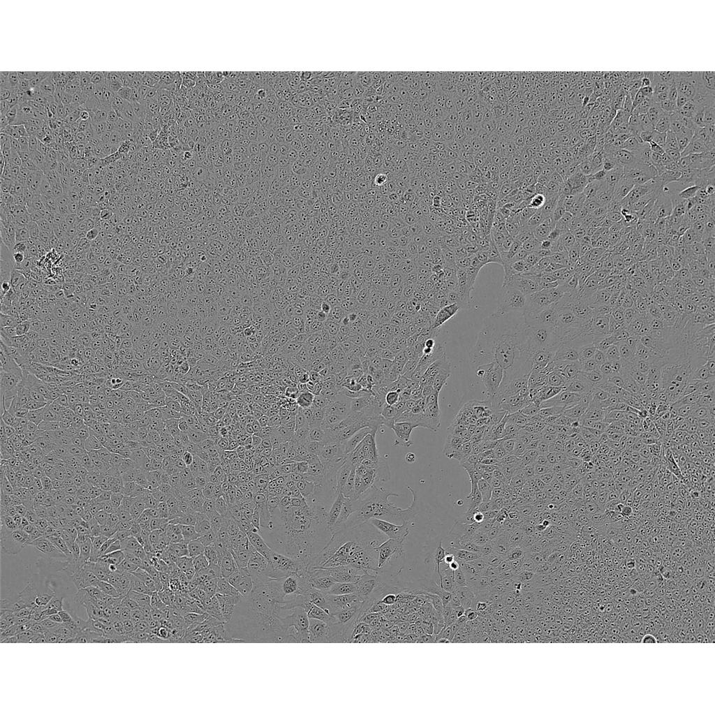 NCIH2170 Cells#人肺鳞癌细胞系种子库|完全培养基|STR图谱