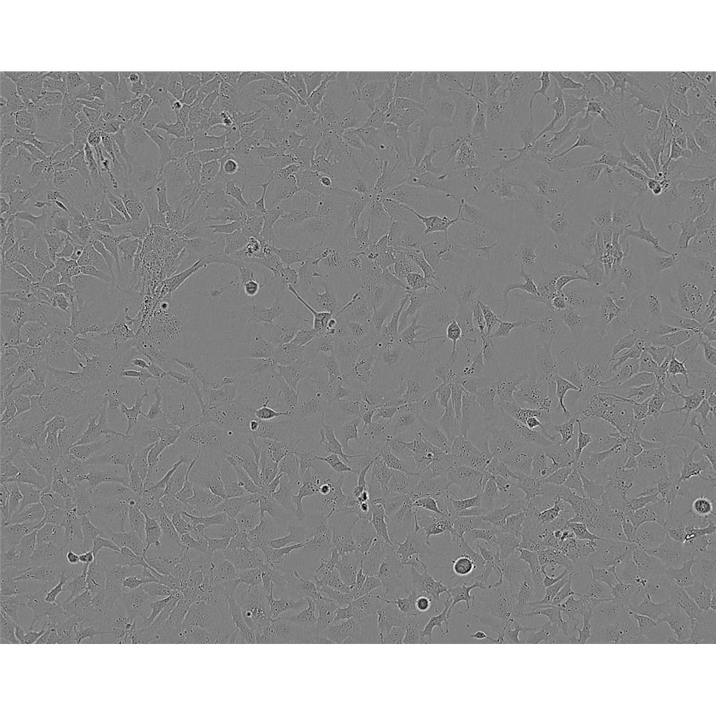 NCIH209 Cells#人小细胞肺癌细胞系种子库|完全培养基|STR图谱