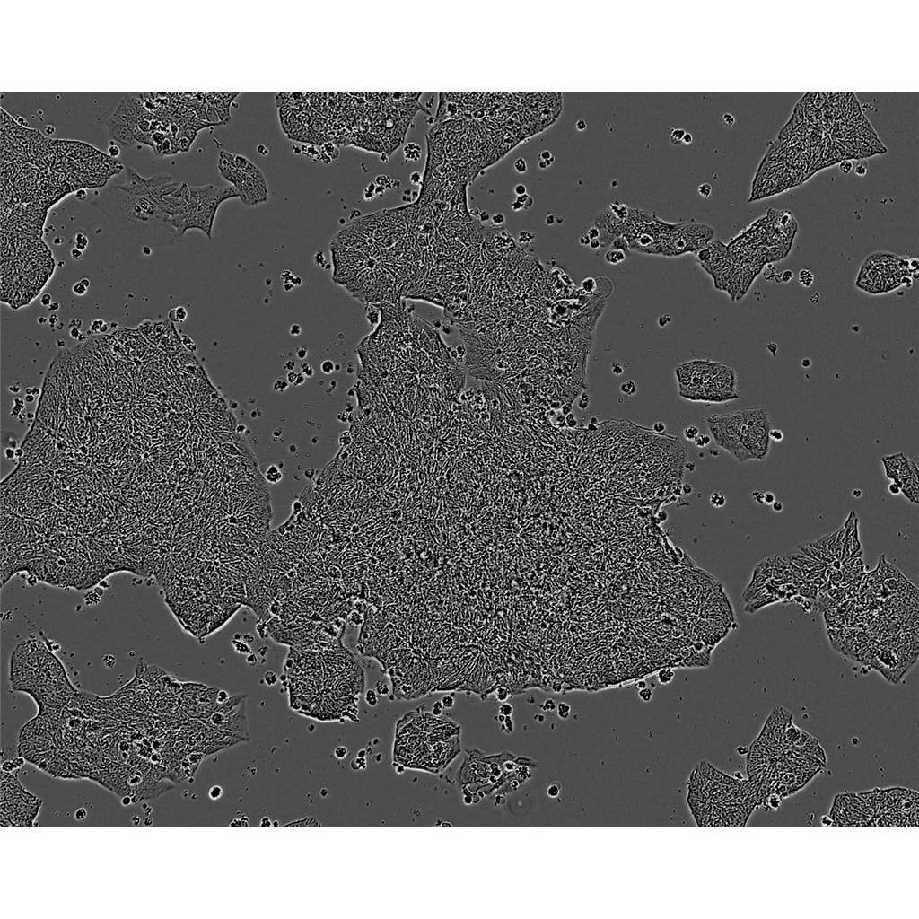 NCIH2347 Cells#人非小细胞肺癌细胞系种子库|完全培养基|STR图谱