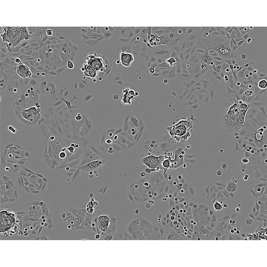 ME180 Cells#人子宫颈表皮癌细胞系种子库|完全培养基|STR图谱