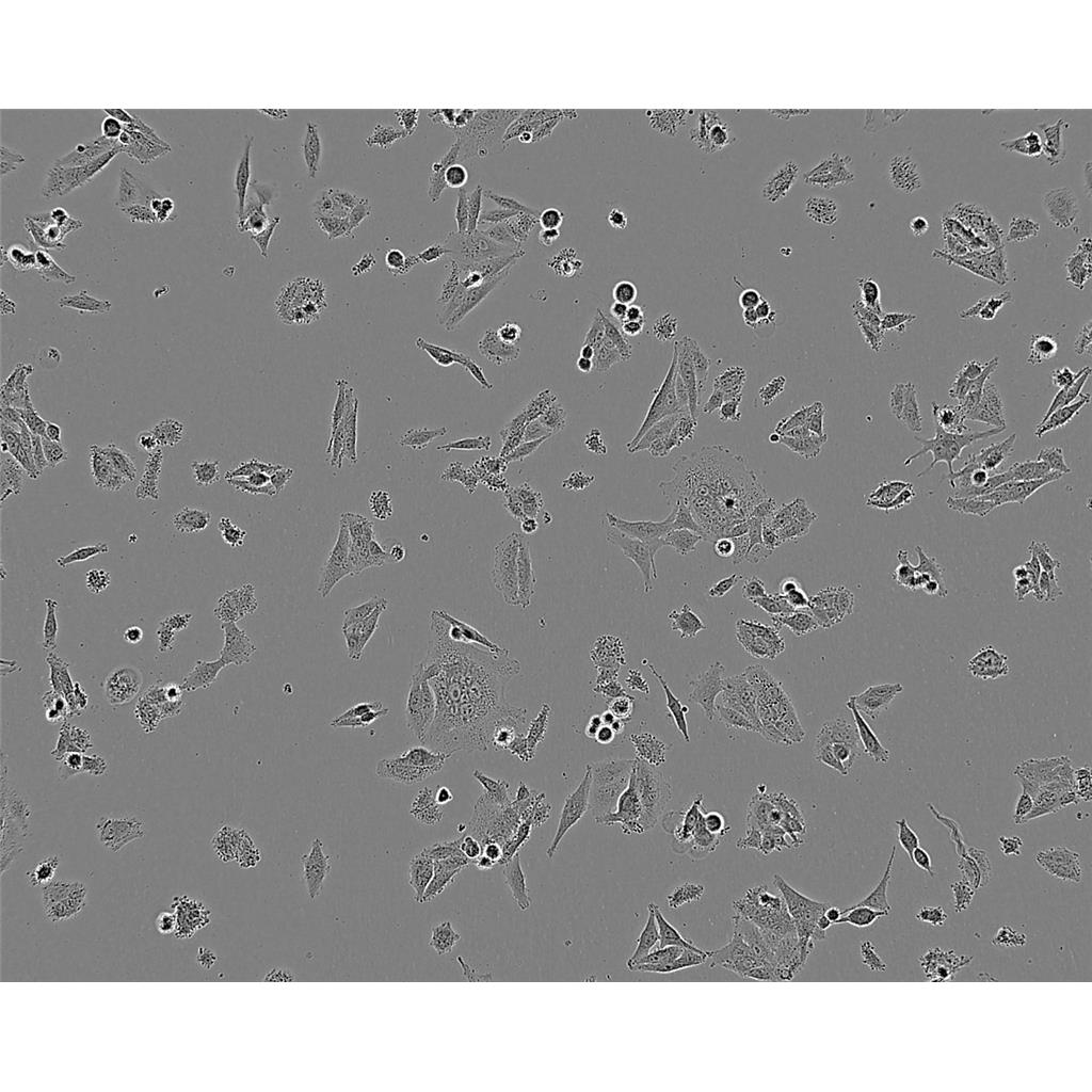 MCA38 Cells#结肠癌细胞系种子库|完全培养基|STR图谱