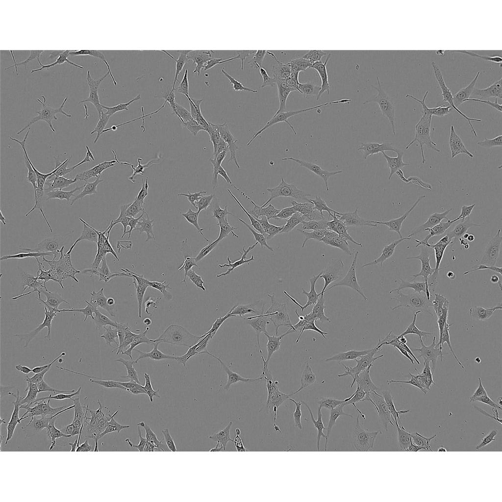 SW.620 Cells#人结肠癌细胞系种子库|完全培养基|STR图谱