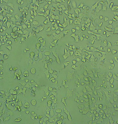 SW 982 Cells#人滑膜肉瘤细胞系种子库|完全培养基|STR图谱