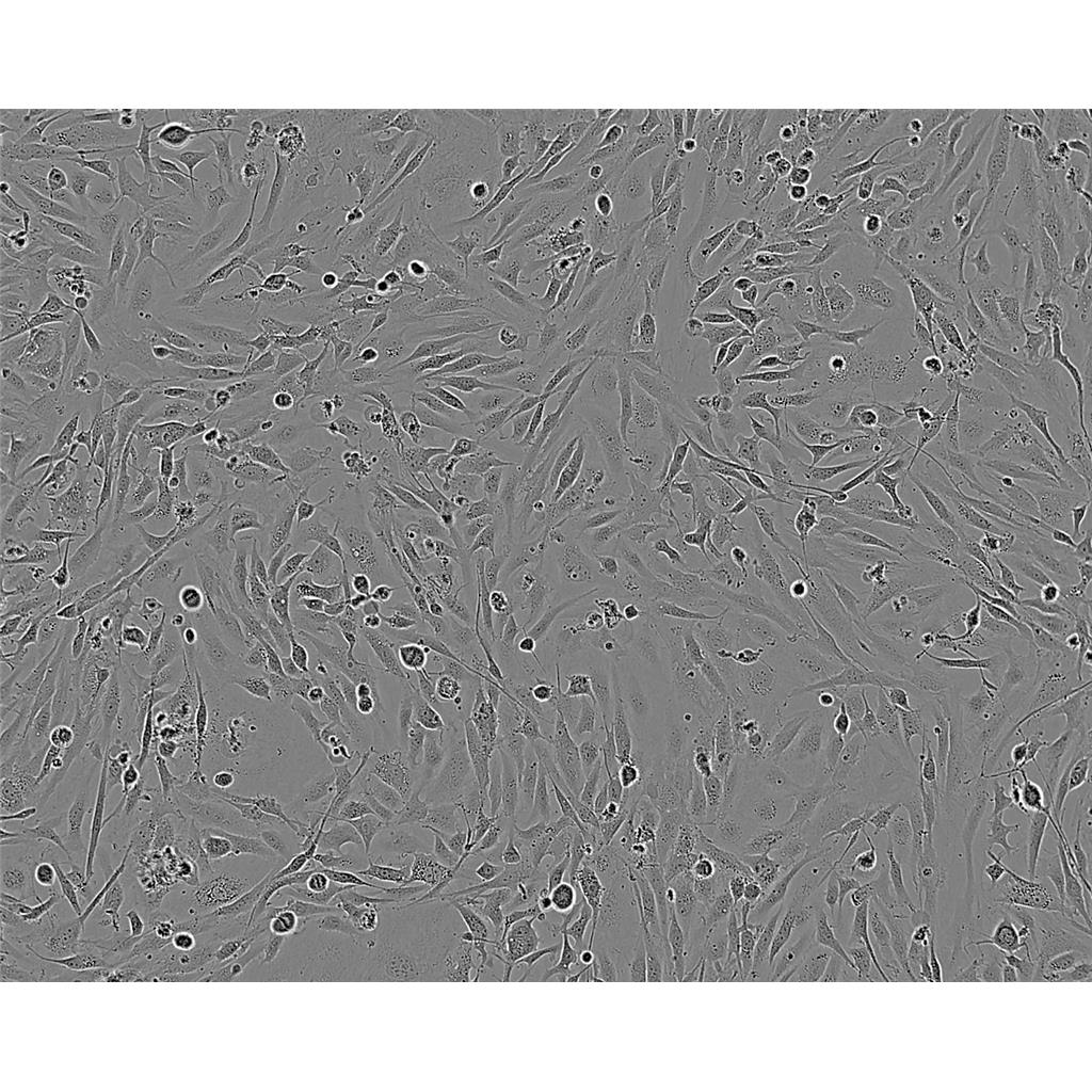 RPMI2650 Cells#人鼻腔上皮细胞系种子库|完全培养基|STR图谱