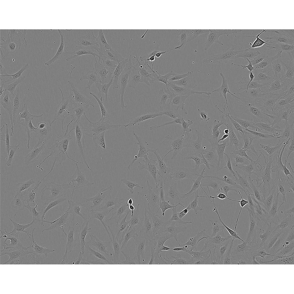 KYSE30 Cells#人食道癌细胞系种子库|完全培养基|STR图谱