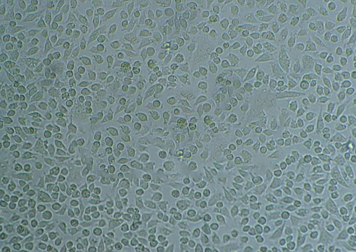 SW 1116 Cells#人结肠癌细胞系种子库|完全培养基|STR图谱