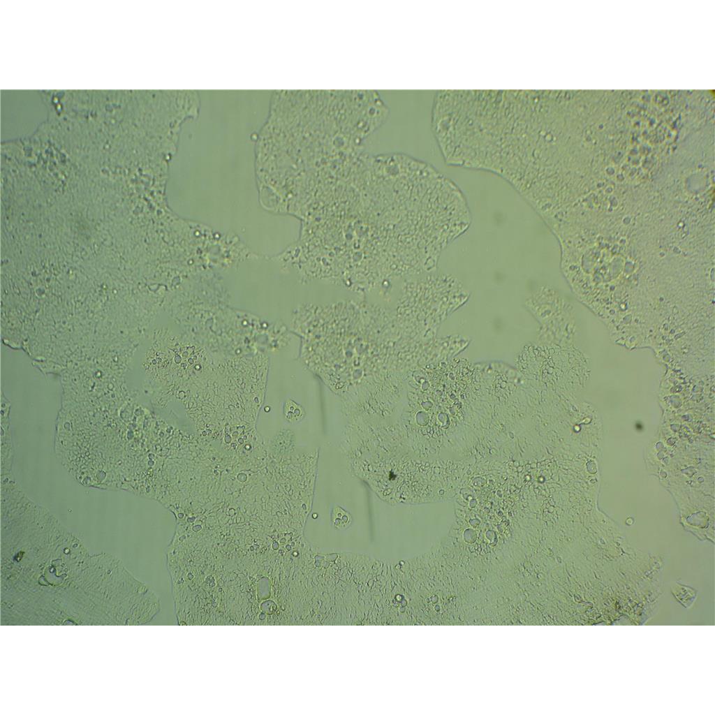 CT-26 Cells#小鼠结肠癌细胞系种子库|完全培养基|STR图谱