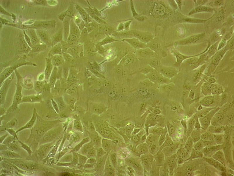 NCI.H23 Cells#人非小细胞肺癌细胞系种子库|完全培养基|STR图谱