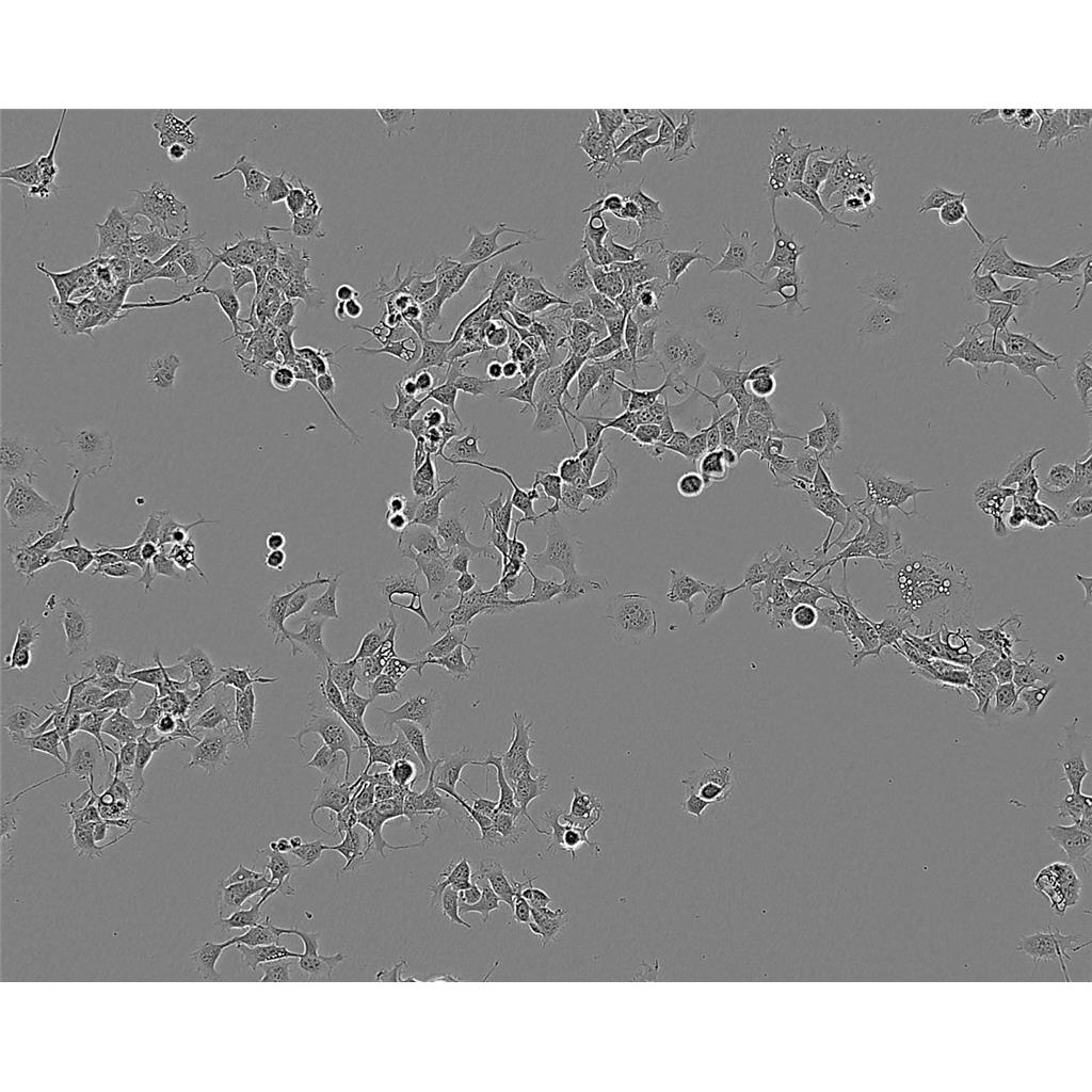 NRK 52E Cells#正常大鼠肾细胞系种子库|完全培养基|STR图谱
