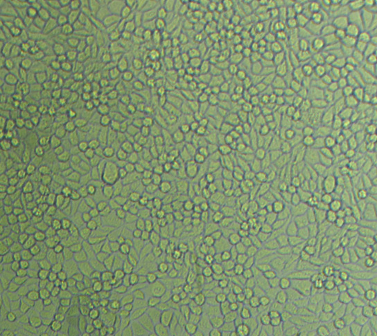 TE1 Cells#人食管癌细胞系种子库|完全培养基|STR图谱