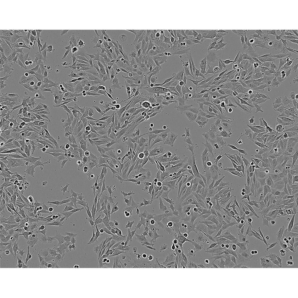 T-24 Cells#人膀胱移行细胞癌细胞系种子库|完全培养基|STR图谱