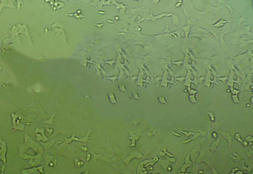 SW-579 Cells#人甲状腺鳞癌细胞系种子库|完全培养基|STR图谱