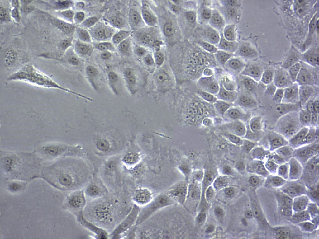 DLD 1 Cells#人结直肠腺癌上皮细胞系种子库|完全培养基|STR图谱
