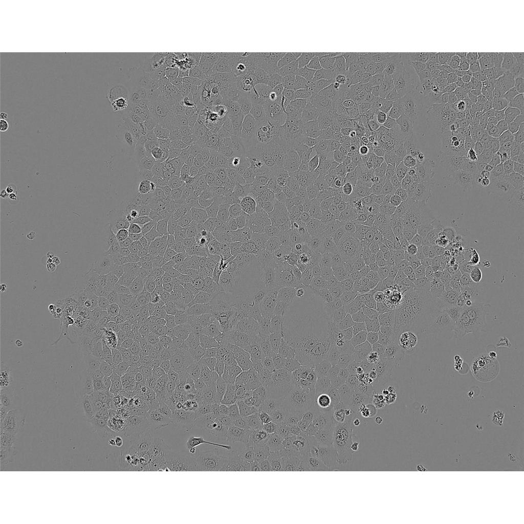 J774A1 Cells#小鼠单核巨噬细胞系种子库|完全培养基|STR图谱