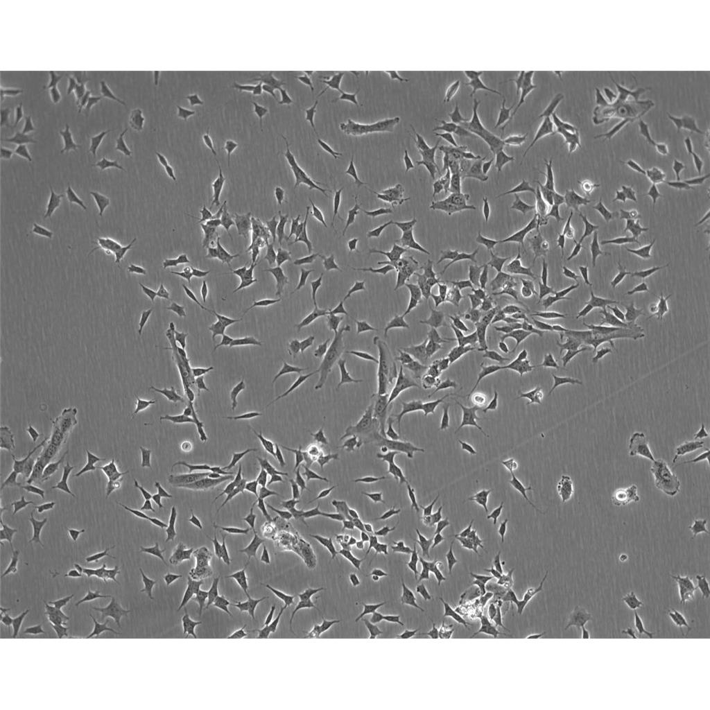 U-118MG Cells#人脑星形胶质母细胞系种子库|完全培养基|STR图谱