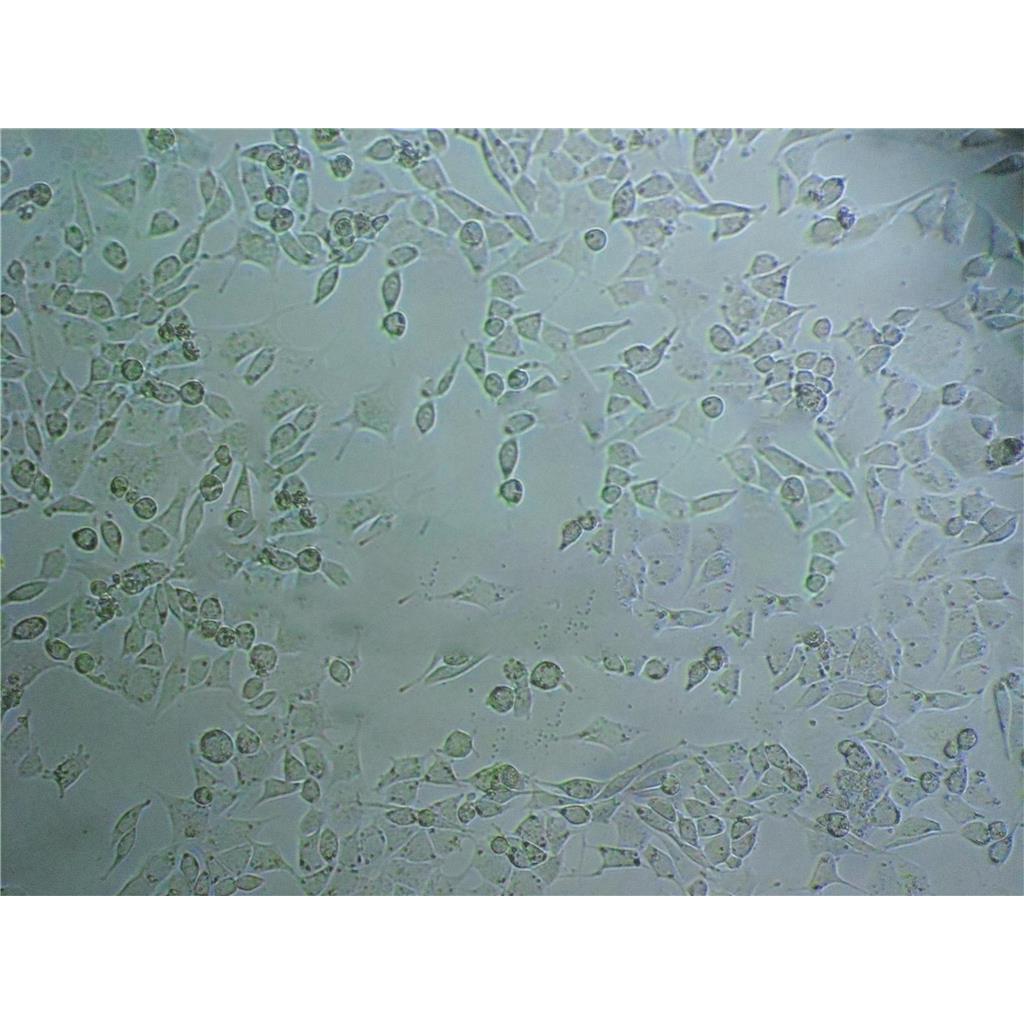 TU 686 Cells#人喉癌细胞系种子库|完全培养基|STR图谱