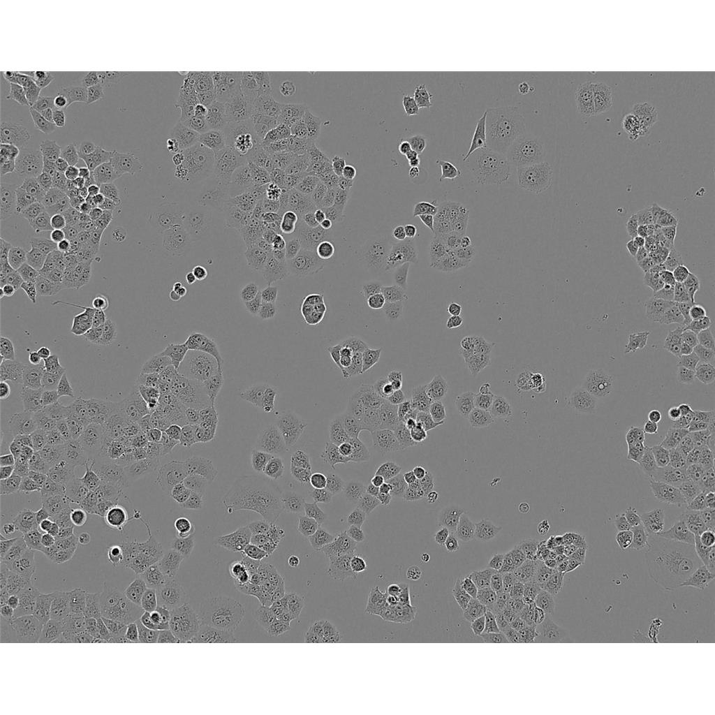 Neuro-2a Cells#小鼠脑神经瘤细胞系种子库|完全培养基|STR图谱