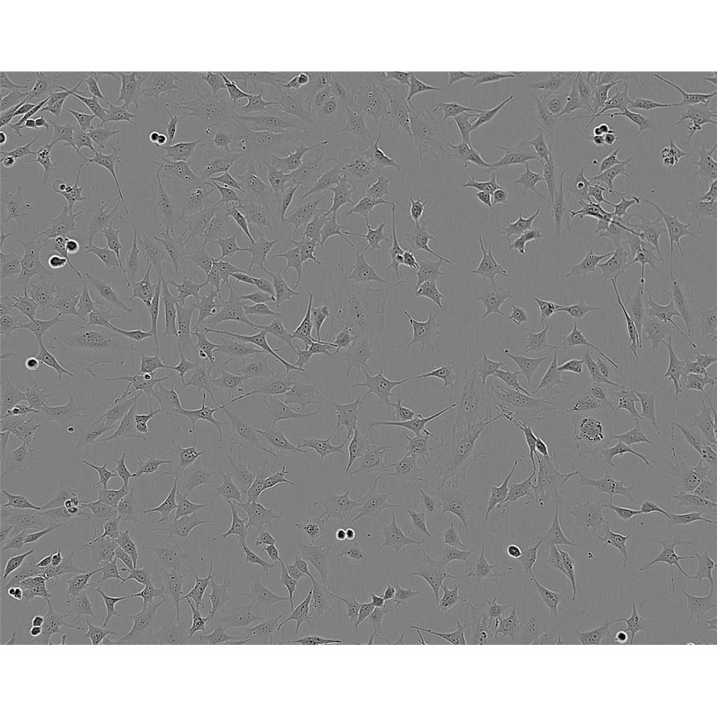 Calu-6 Cells#人退行性癌细胞系低代次|培养基|赠STR图谱