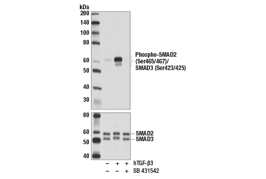 CST磷酸化SMAD2（Ser465/467）/SMAD3（Ser423/425）（D27F4）兔单克隆抗体