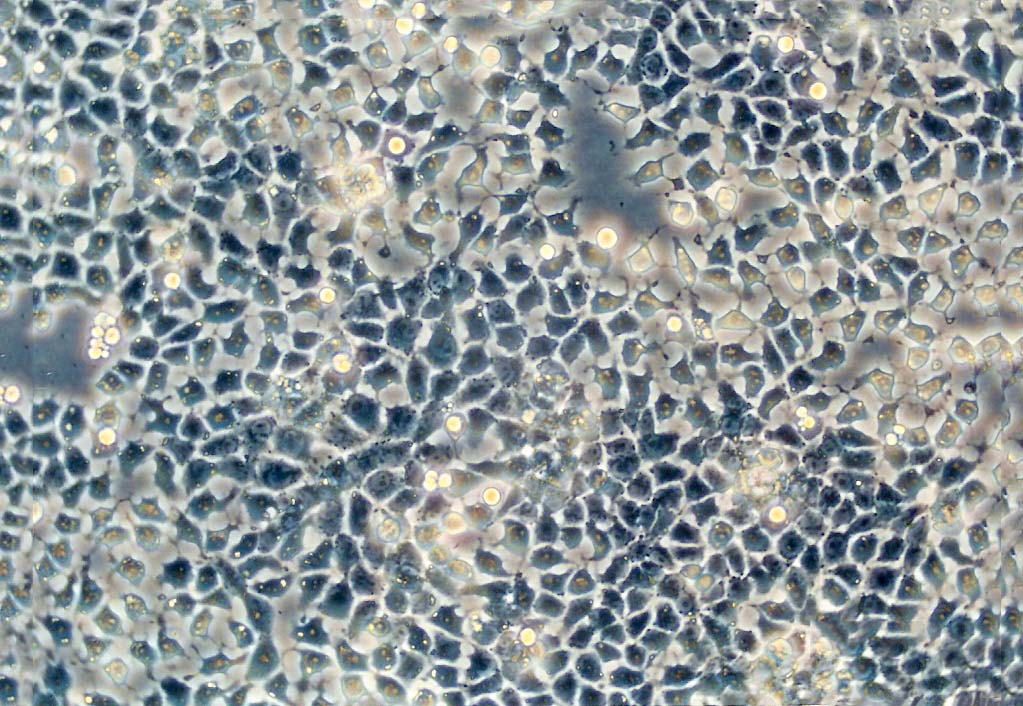 RA 1 Cells#人B淋巴细胞系活性强|培养基|送STR图谱