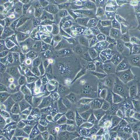 U-2-OS Cells#人骨肉瘤细胞系活性强|培养基|送STR图谱