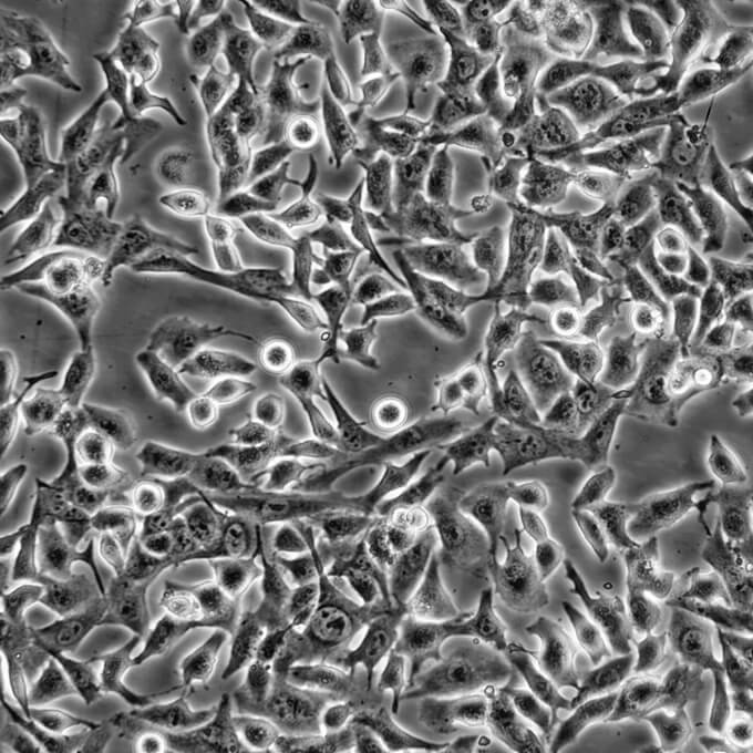 HCC 94 Cells#人子宫鳞癌细胞系活性强|培养基|送STR图谱